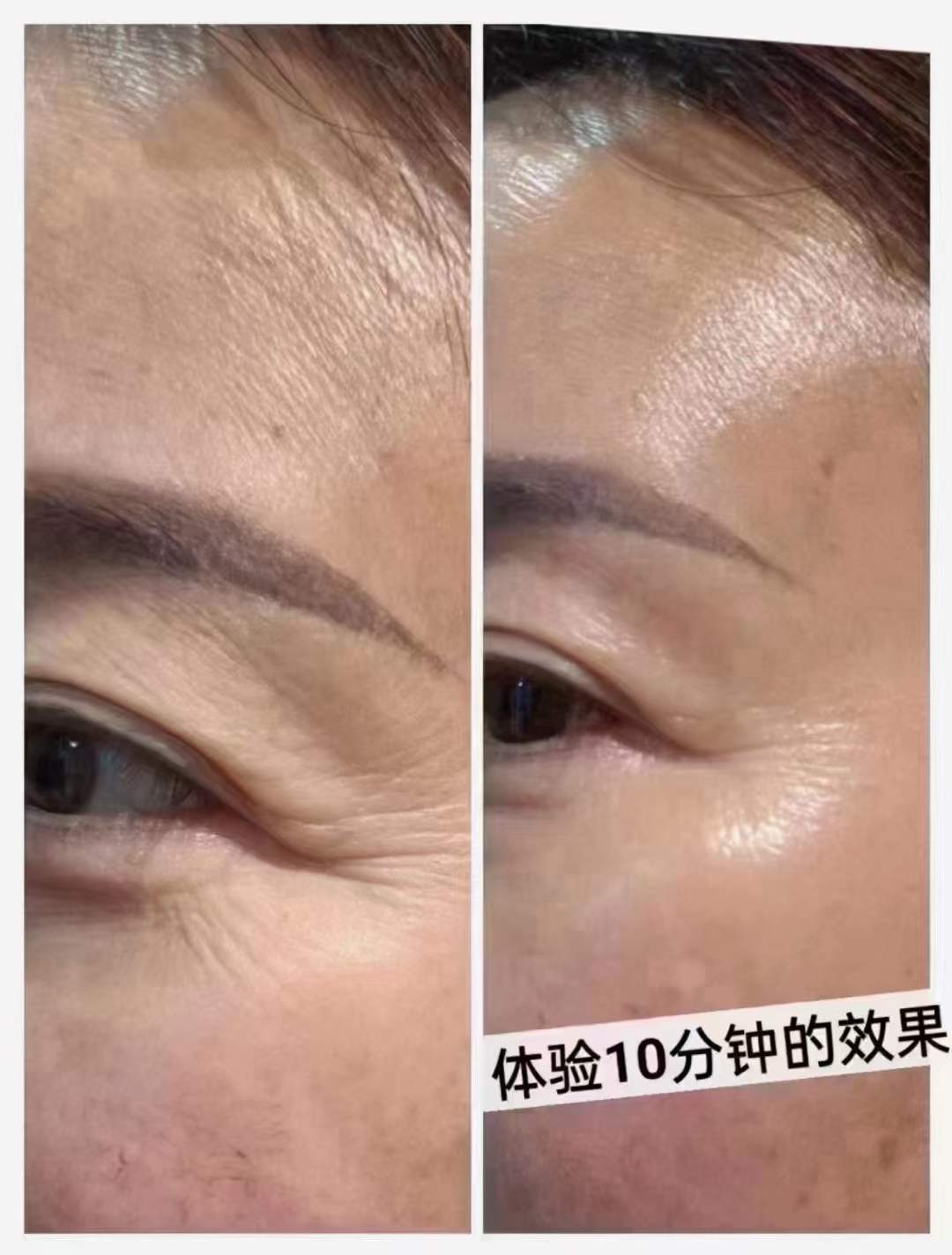 唐女士地推项目招募逆龄喷雾推广员提成940元一套