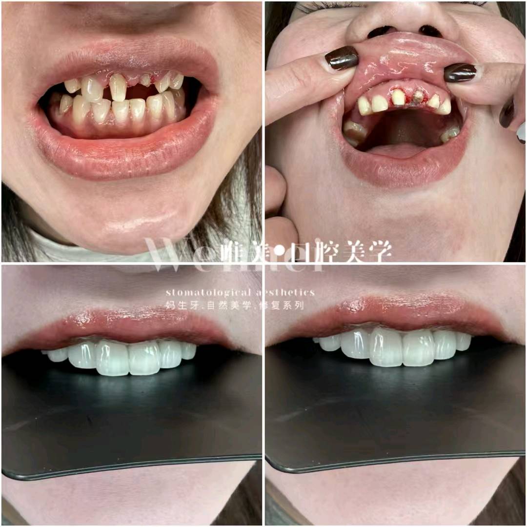 赵先生美牙项目招合伙人+收学员！一手技术，高佣日结，小白也能赚