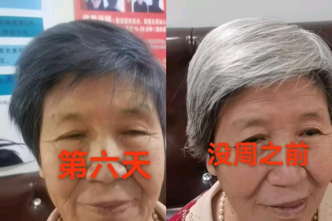 苟平寻找合作伙伴，提供养发洗发露项目，解决4.5亿白发人群需求，共创市场