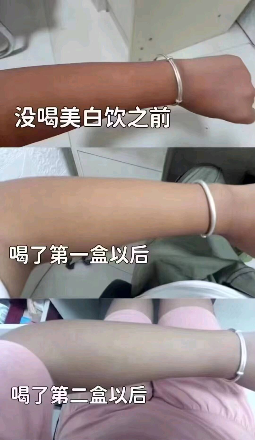 付女士美白瘦身祛痘护肤