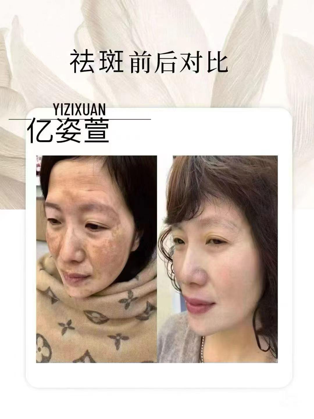 夏晓丰找合伙人问题性肌肤-斑敏痘痣疣，专做别人做不了的斑，90%的人有需求