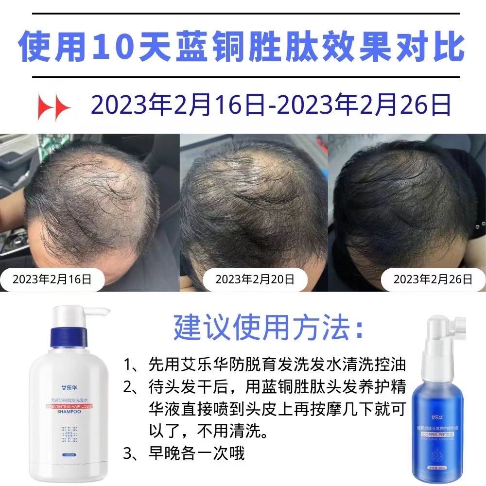 刘先生品牌货源生物科技蓝铜胜肽生发精华及特化证洗发水