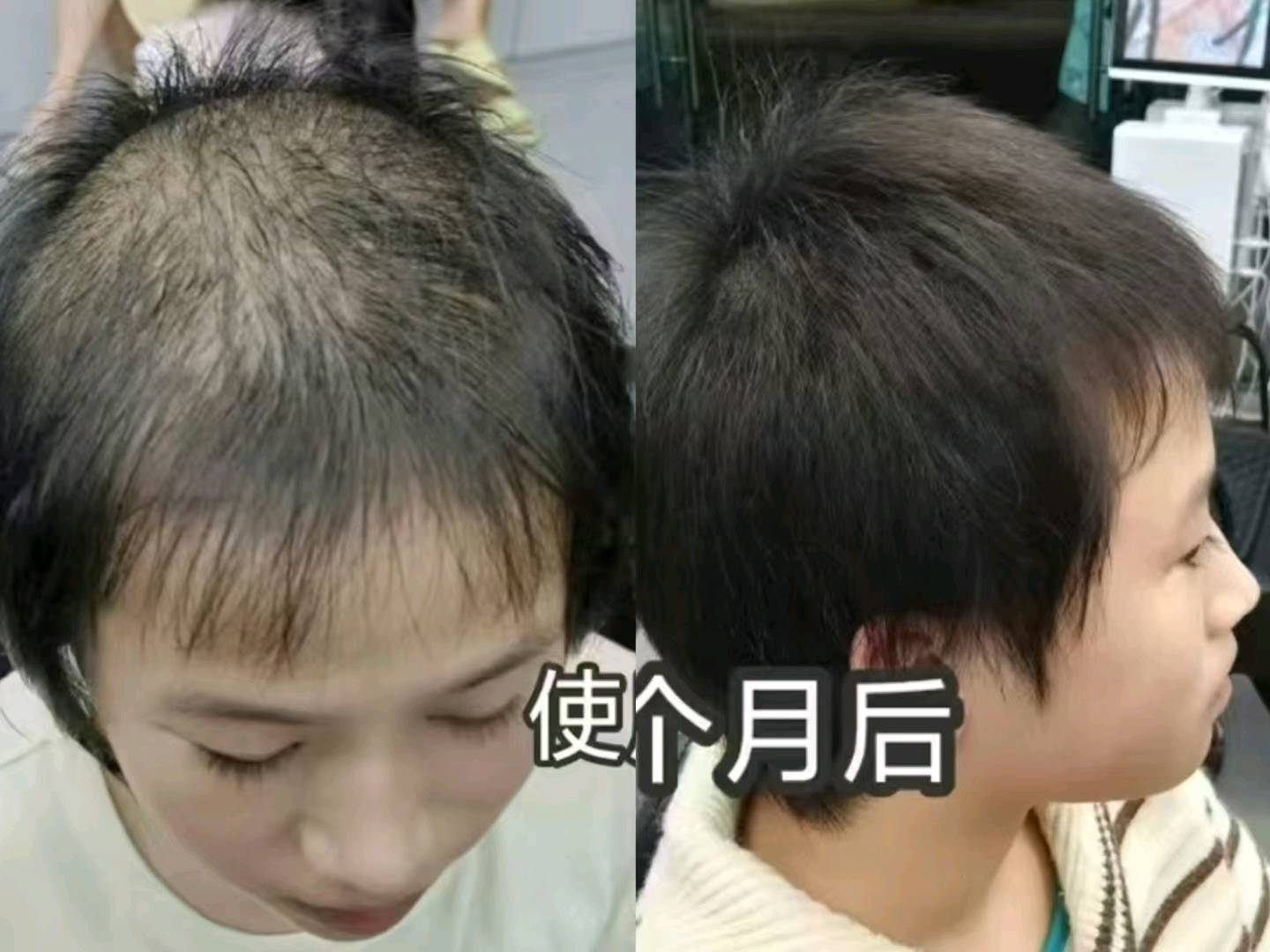 胡华琴找合伙人防脱生发控油去屑，寻找有需要的客户合作
