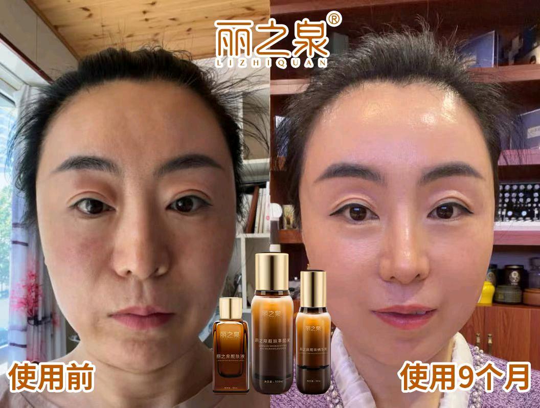 毛先生找合伙人SOD生物调肤抗衰*