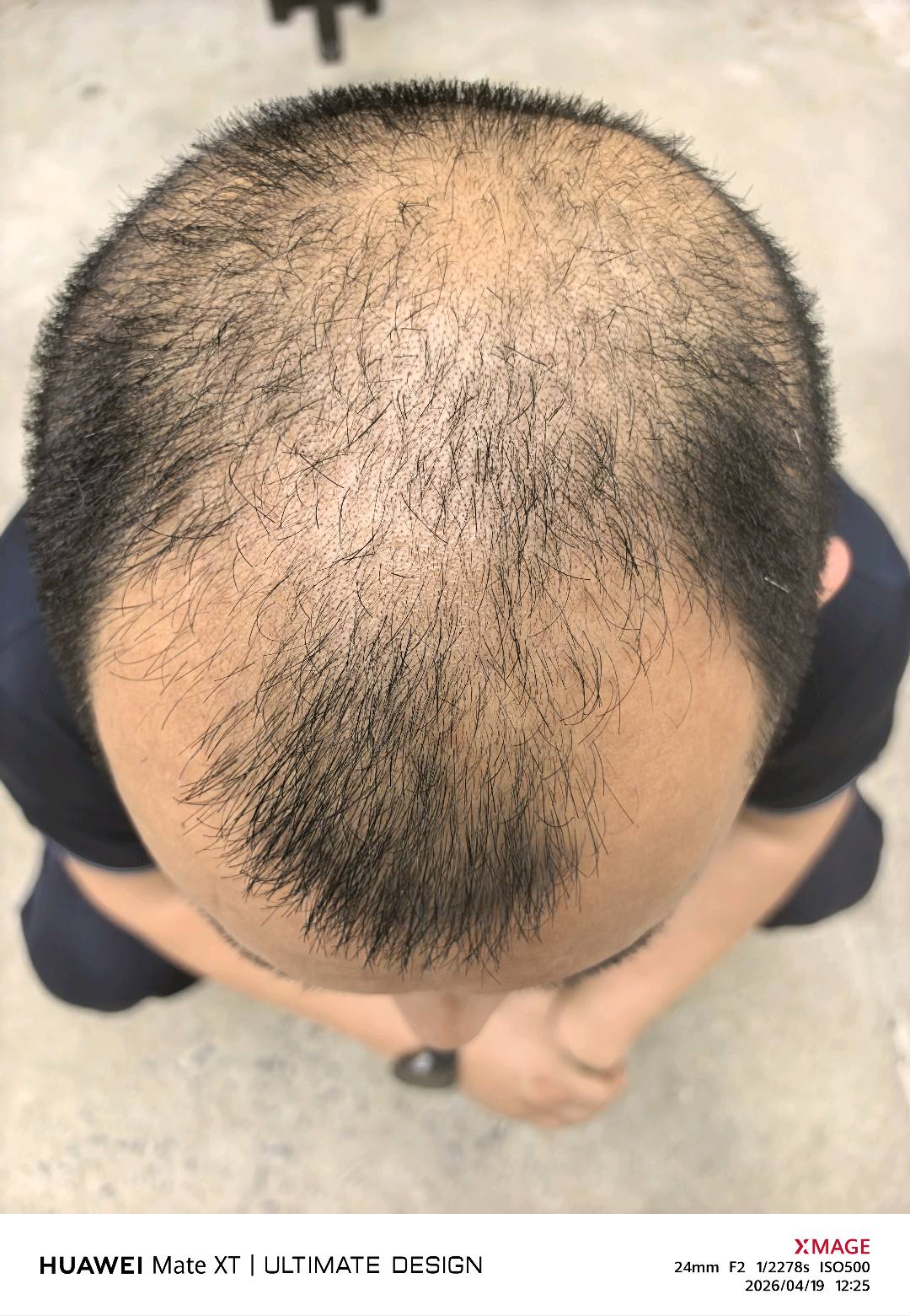 石志路找合伙人