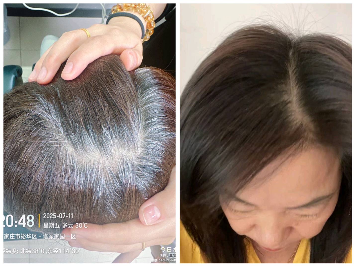 刘盛山诚邀全国代理，森发哆国妆特字防脱精华，银发经济，140项检测保障