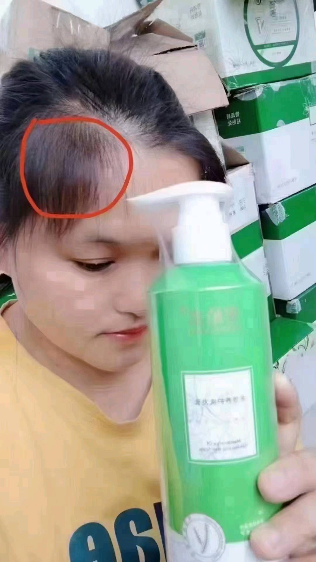 杨业泽蜜植素代理分销