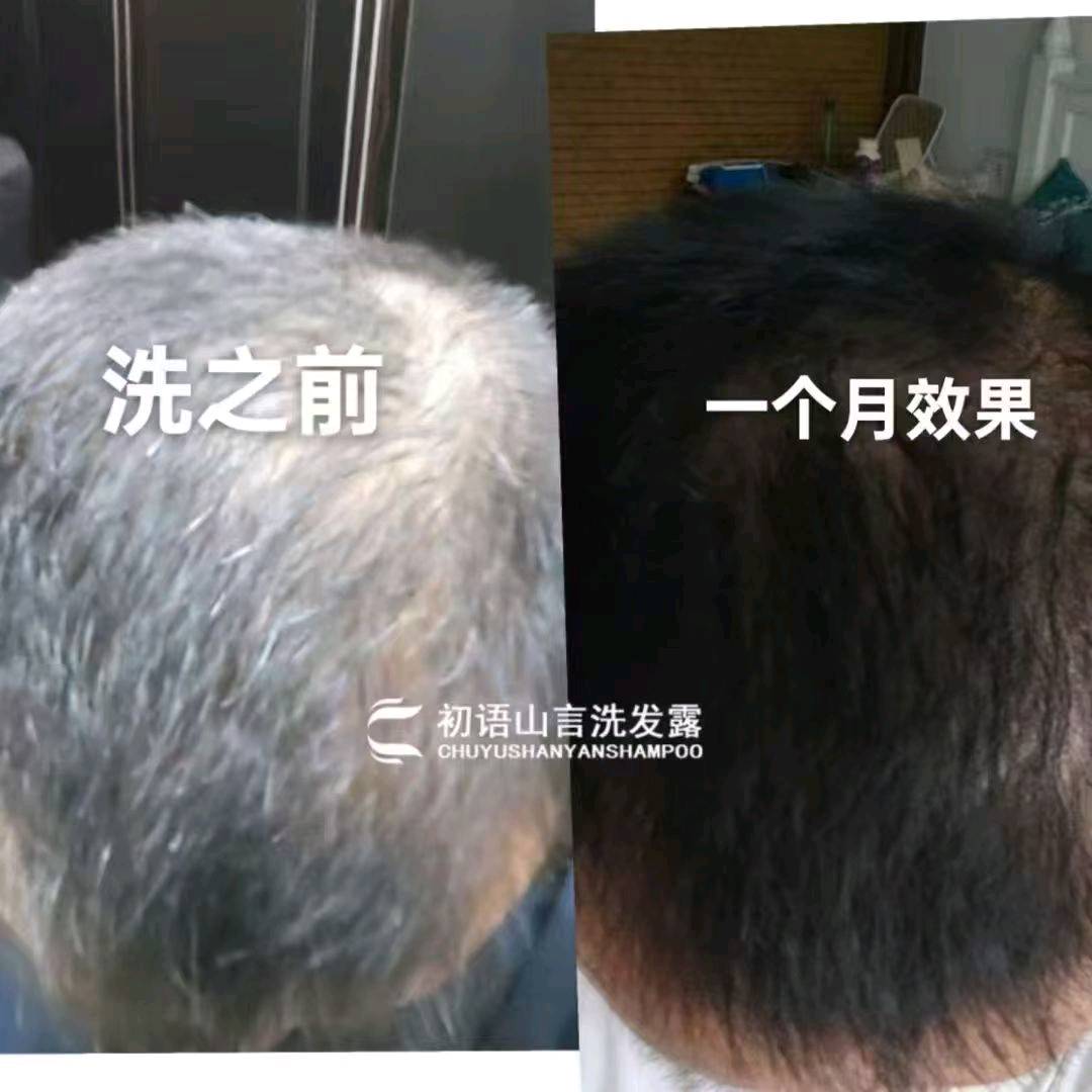 张恒找合伙人白发养黑一款洗发水引爆万亿级市场