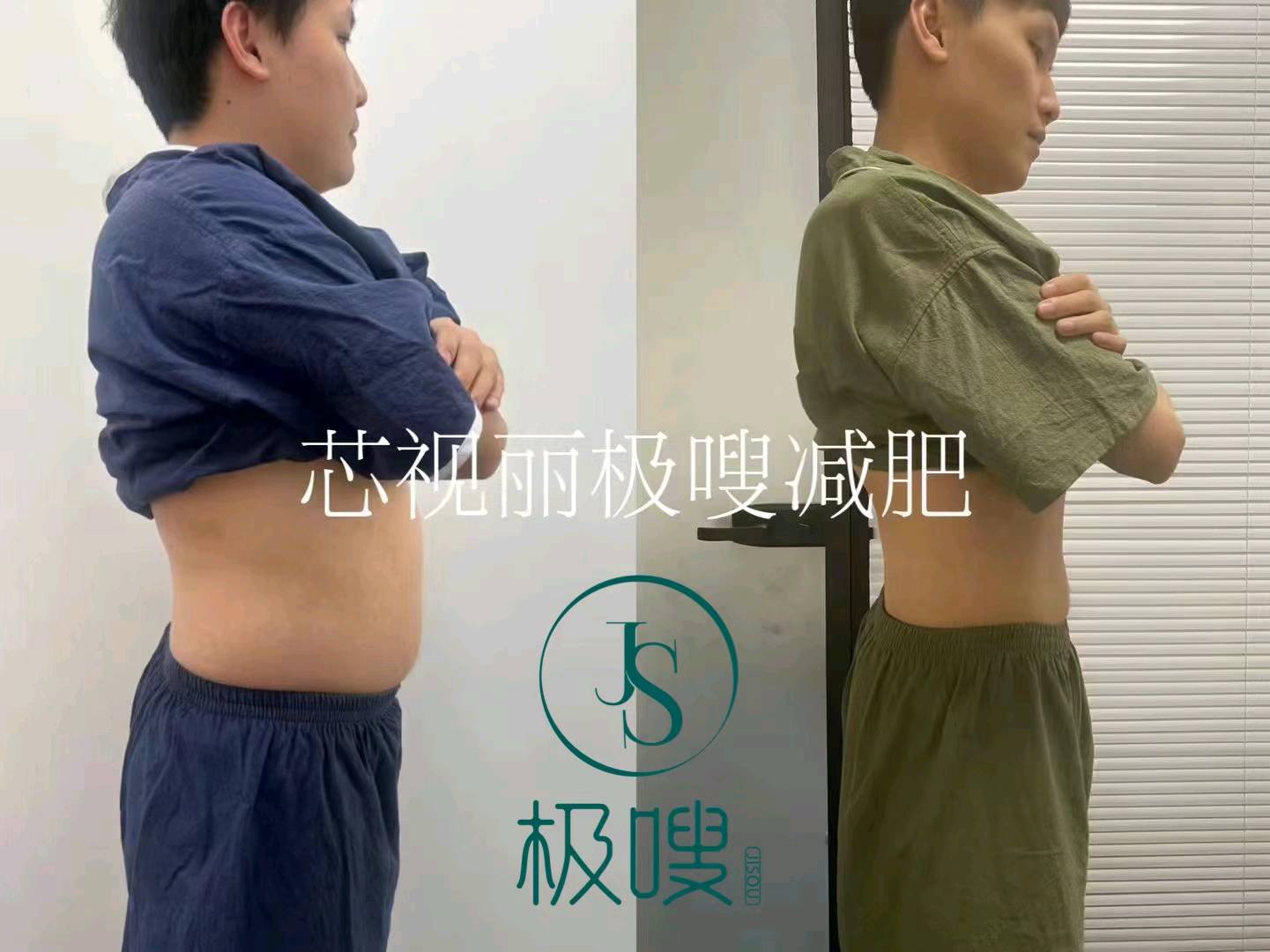 王倩找合伙人芯片减肥