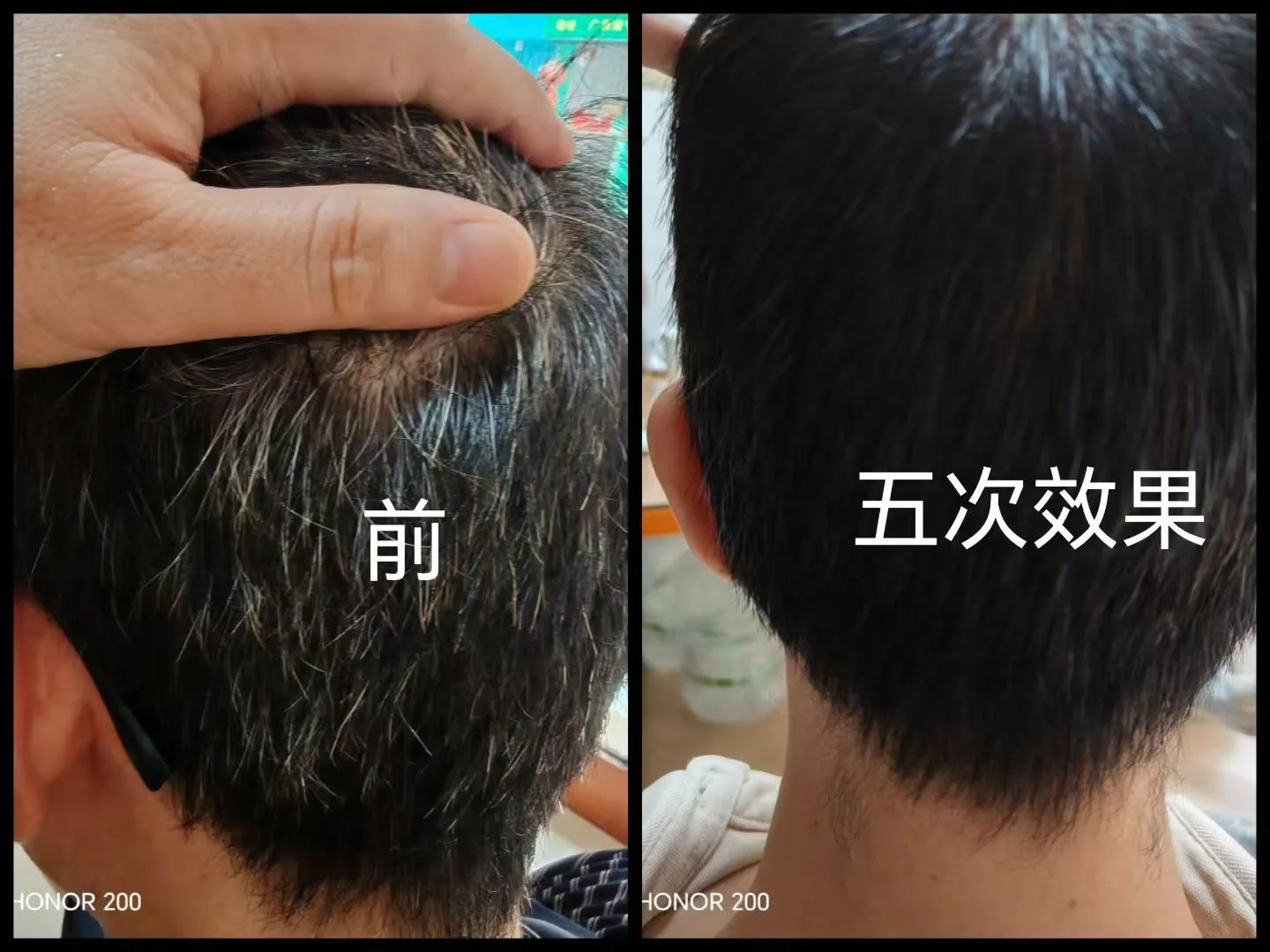 赖先生广西找门店合作白转黑洗发水套装